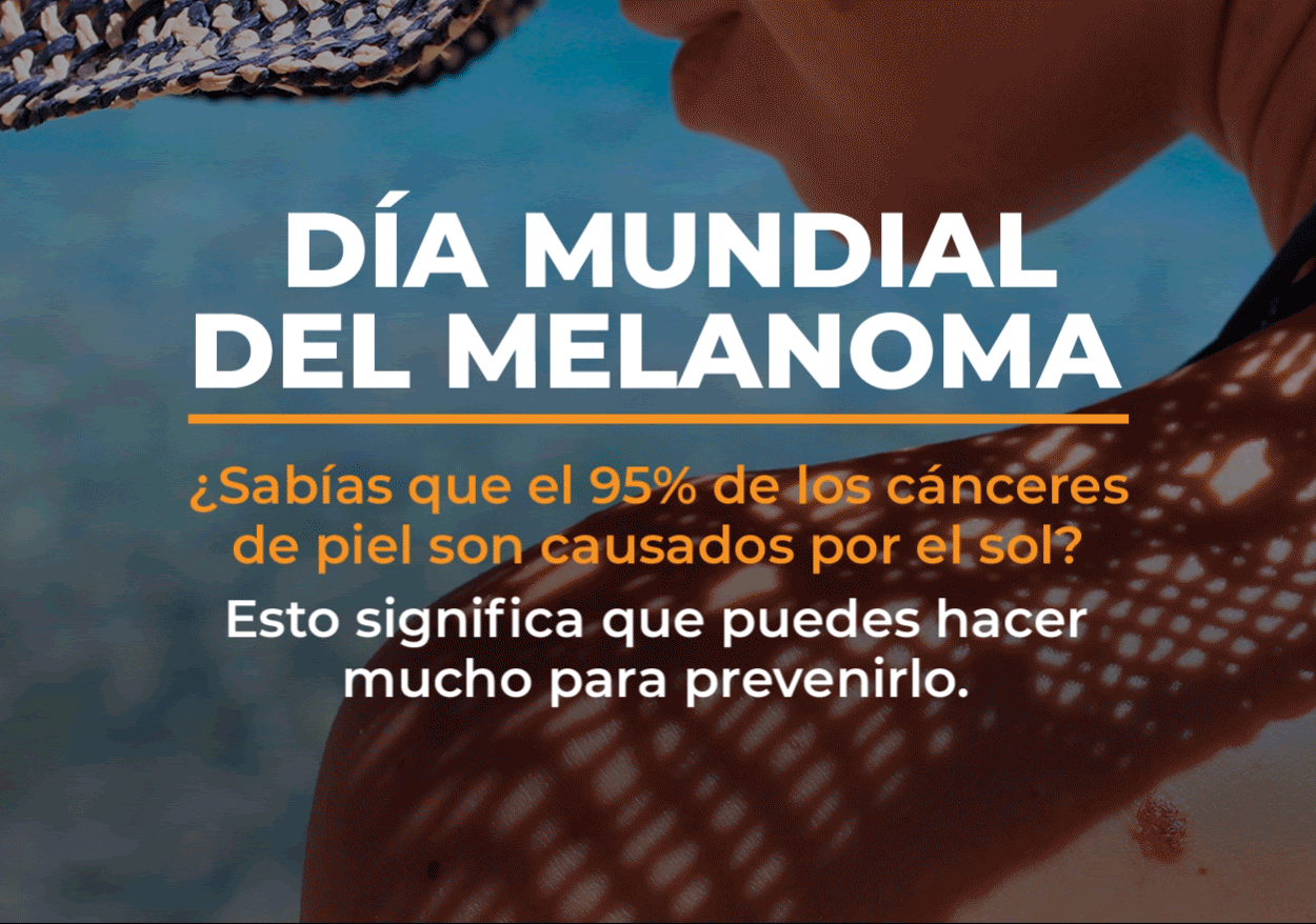 Día Mundial del Melanoma